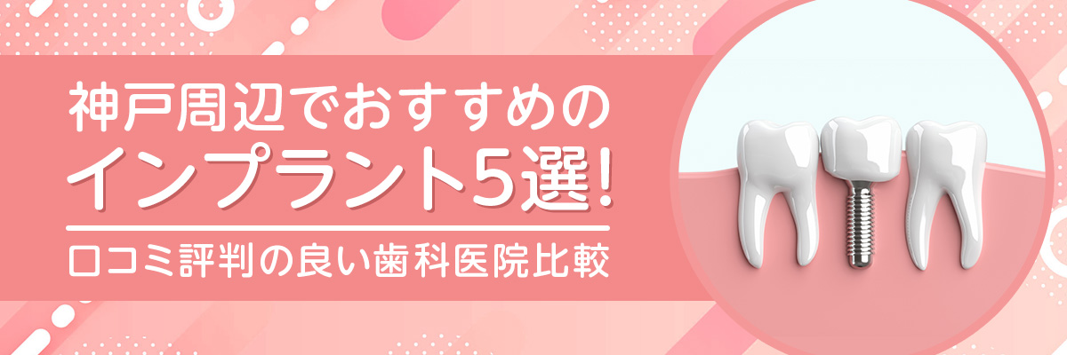 神戸周辺でおすすめのインプラント5選！口コミ評判の良い歯科医院比較