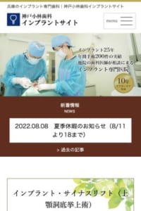 インプラントで歯を意識しない快適な食生活を取り戻す「神戸小林歯科」